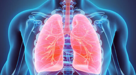 5 main treatments for lung cancer