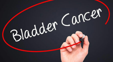 Bladder cancer &#8211; Signs to look out for