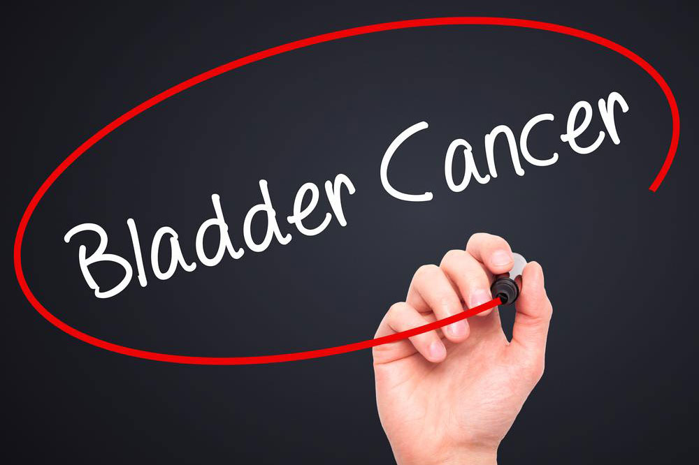 Bladder cancer &#8211; Signs to look out for