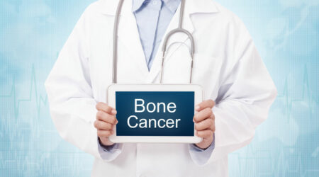 Causes, symptoms, and treatment options for bone cancer