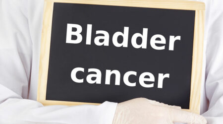 Popular treatment options for bladder cancer