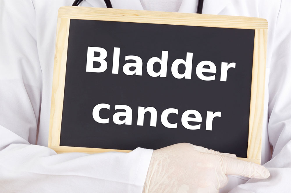 Popular treatment options for bladder cancer