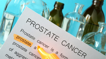 Prostate cancer &#8211; Causes, signs, and treatment methods