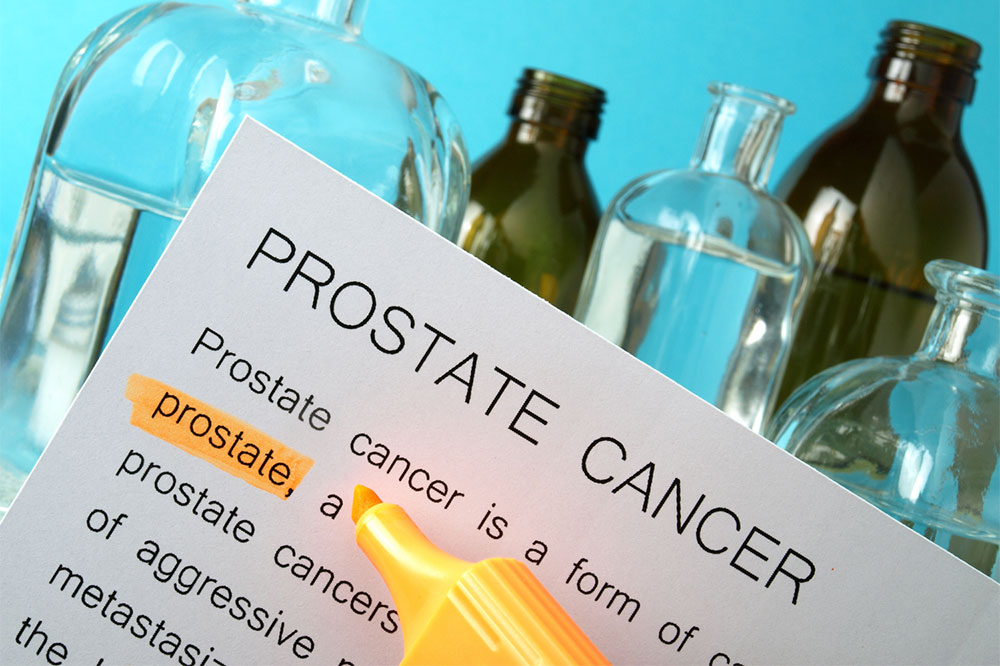 Prostate cancer &#8211; Causes, signs, and treatment methods