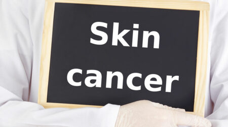 Skin cancer &#8211; Symptoms, causes, and treatments