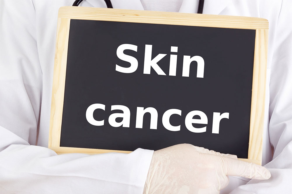 Skin cancer &#8211; Symptoms, causes, and treatments