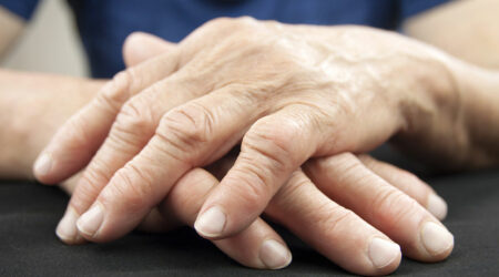 Common types of arthritis and their symptoms