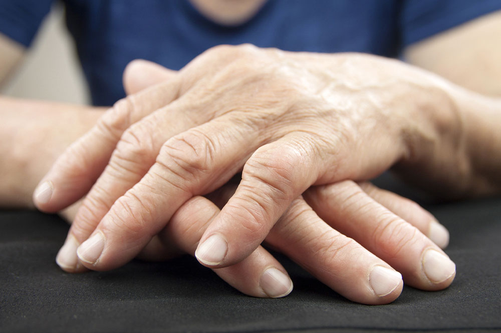 Common types of arthritis and their symptoms