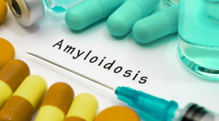 What is amyloidosis and how to deal with it