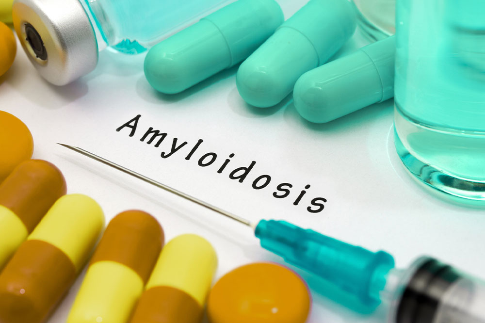 What is amyloidosis and how to deal with it