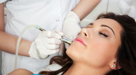 6 things to know about laser resurfacing for acne scars