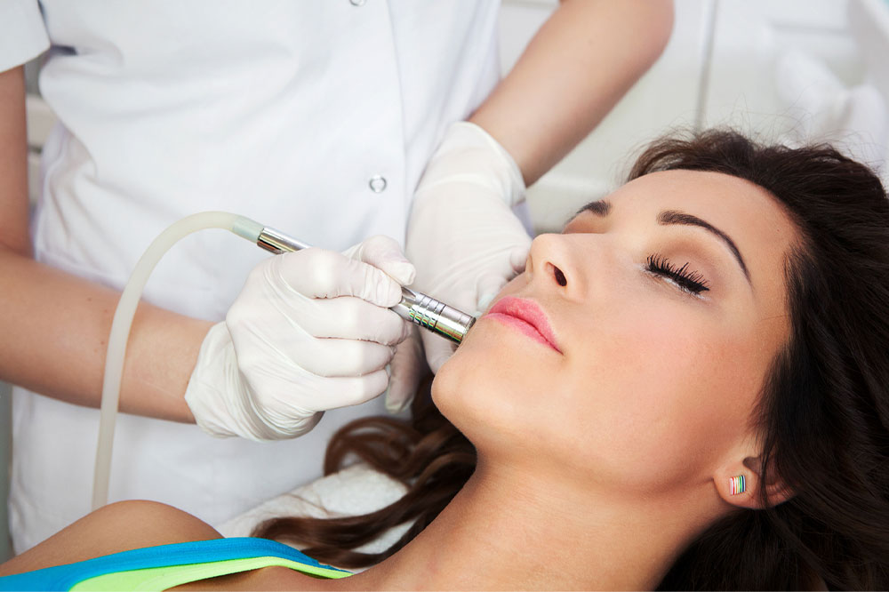 6 things to know about laser resurfacing for acne scars