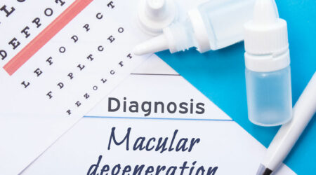 A brief understanding of age-related macular degeneration