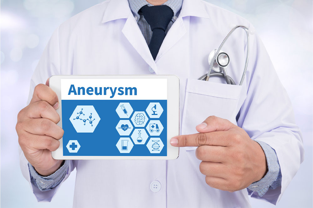 Aneurysm &#8211; Types, symptoms, and other important information