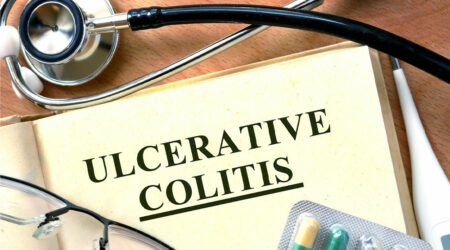 Early signs of ulcerative colitis &#8211; Diagnosis and other information