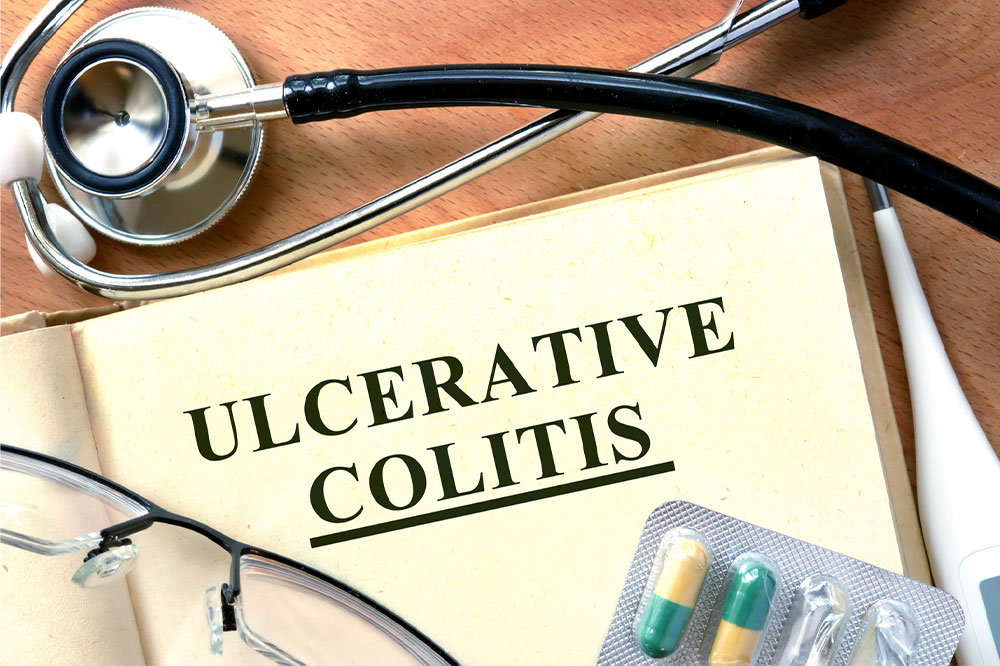 Early signs of ulcerative colitis &#8211; Diagnosis and other information