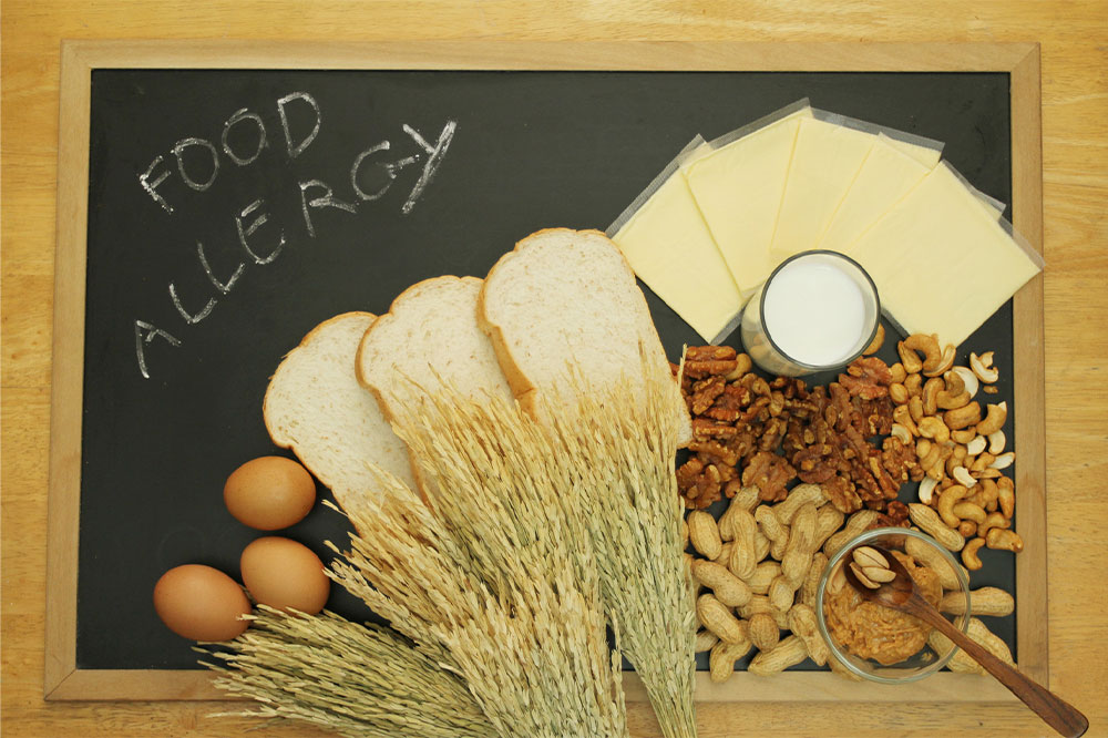 Food allergies &#8211; Their triggers and relief options