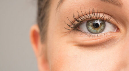 Main causes of bags under eyes and 4 remedies for it