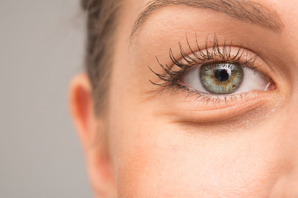 Main causes of bags under eyes and 4 remedies for it