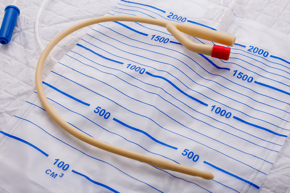 Urinary catheters &#8211; Types and their side effects