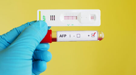 What is an alpha-fetoprotein test