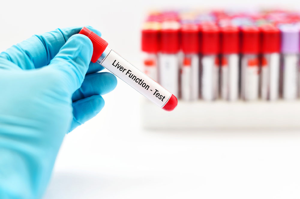 Liver function tests &#8211; Purpose, types, and procedure