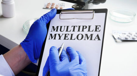 8 common symptoms of multiple myeloma