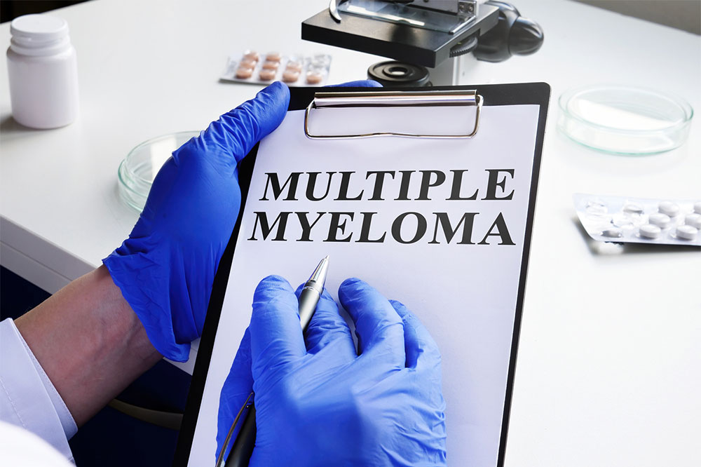 8 common symptoms of multiple myeloma