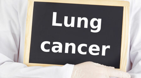 Lung cancer and its major causes, signs, and treatments