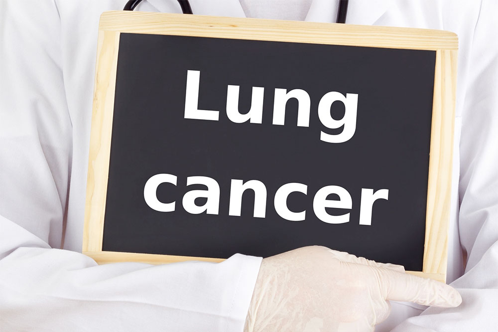 Lung cancer and its major causes, signs, and treatments