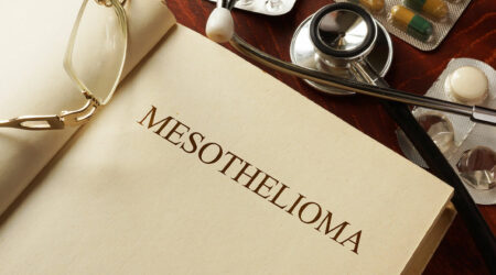 Mesothelioma cancer &#8211; Symptoms, causes, and stages