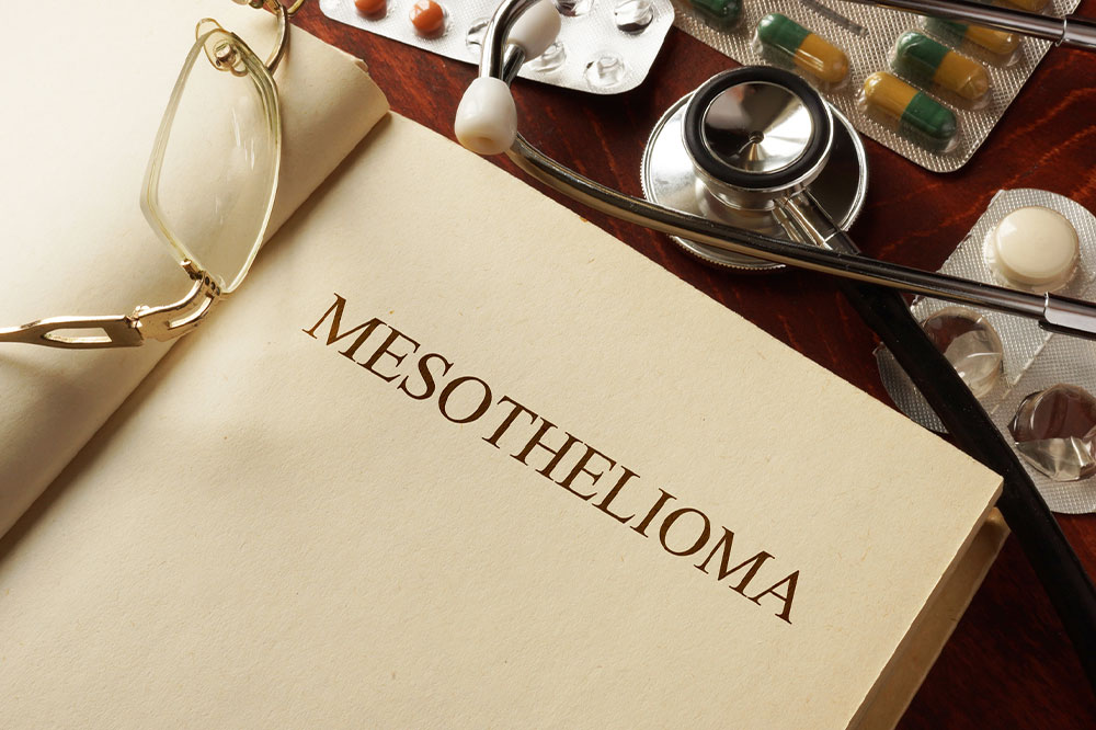 Mesothelioma cancer &#8211; Symptoms, causes, and stages