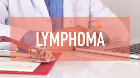 Lymphoma cancer &#8211; Its symptoms, risk factors, and prevention