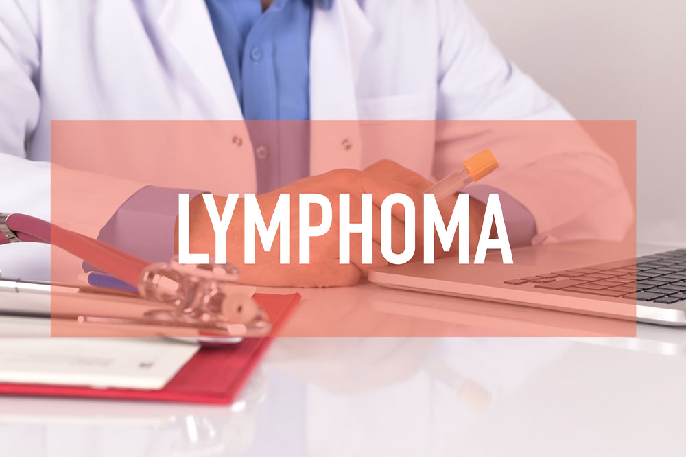 Lymphoma cancer &#8211; Its symptoms, risk factors, and prevention