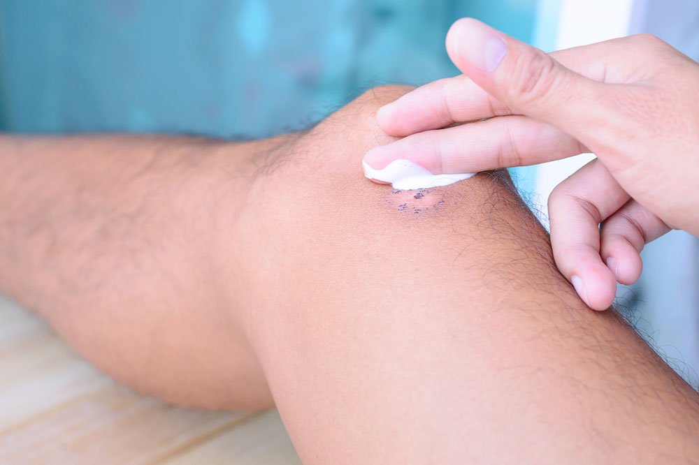 6 effective methods to help remove scar tissue