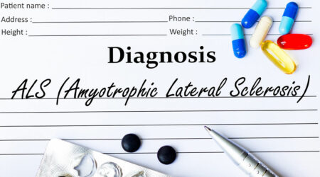 Amyotrophic lateral sclerosis &#8211; Symptoms, causes, and management