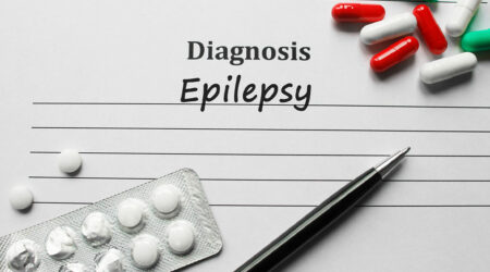 Causes, symptoms, and management tips for epilepsy