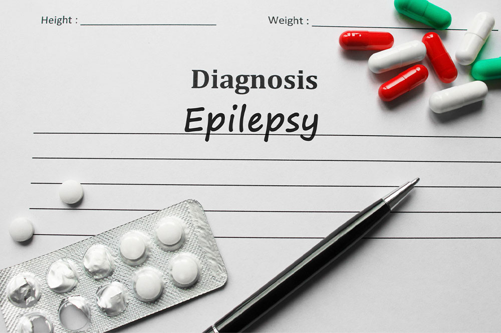 Causes, symptoms, and management tips for epilepsy