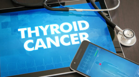 Thyroid cancer &#8211; Symptoms, types, and management options