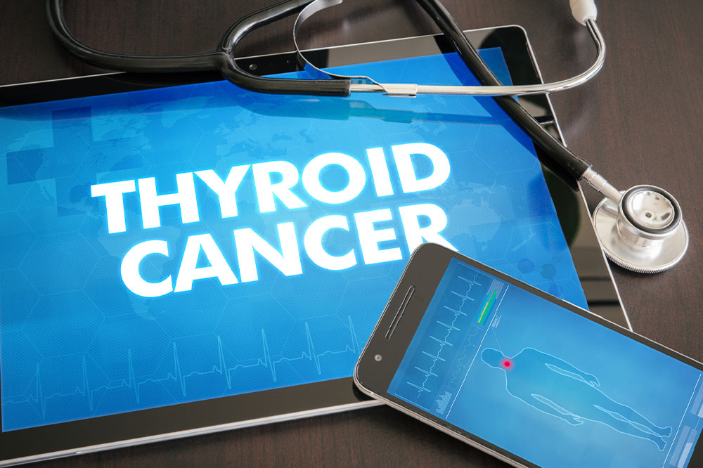 Thyroid cancer &#8211; Symptoms, types, and management options