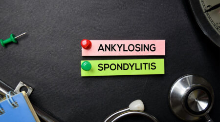 Ankylosing spondylitis &#8211; Causes, symptoms, and management options