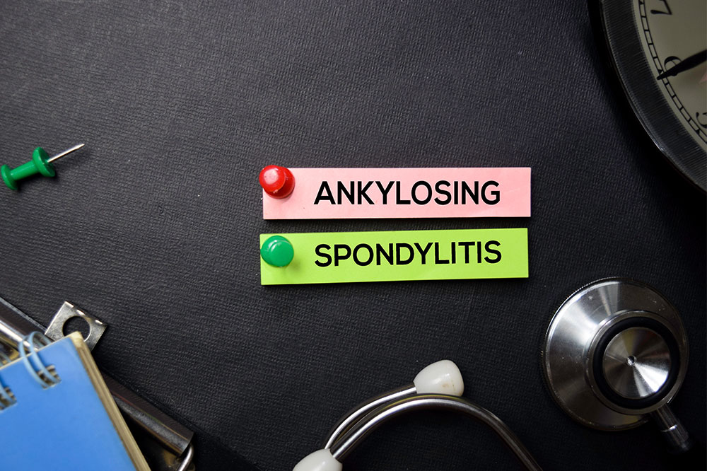 Ankylosing spondylitis &#8211; Causes, symptoms, and management options