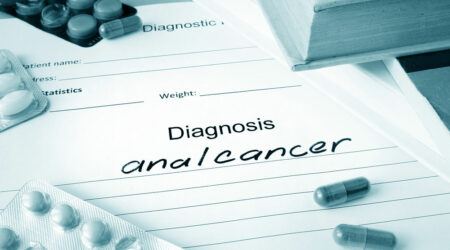 Anal cancer – Symptoms, management options, and more