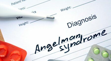 Angelman syndrome &#8211; Signs, causes, and management