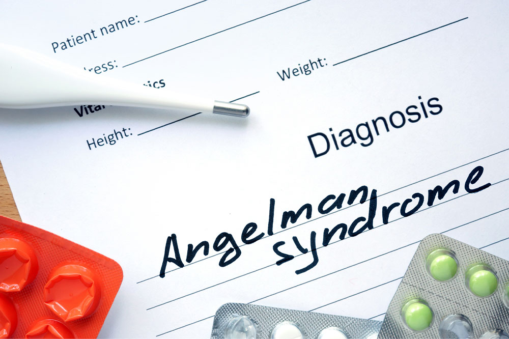 Angelman syndrome &#8211; Signs, causes, and management