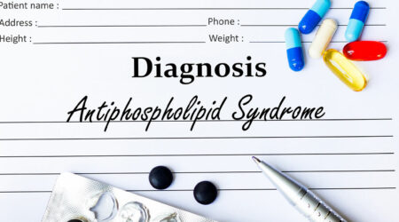 Antiphospholipid syndrome &#8211;  Symptoms, diagnosis, and more