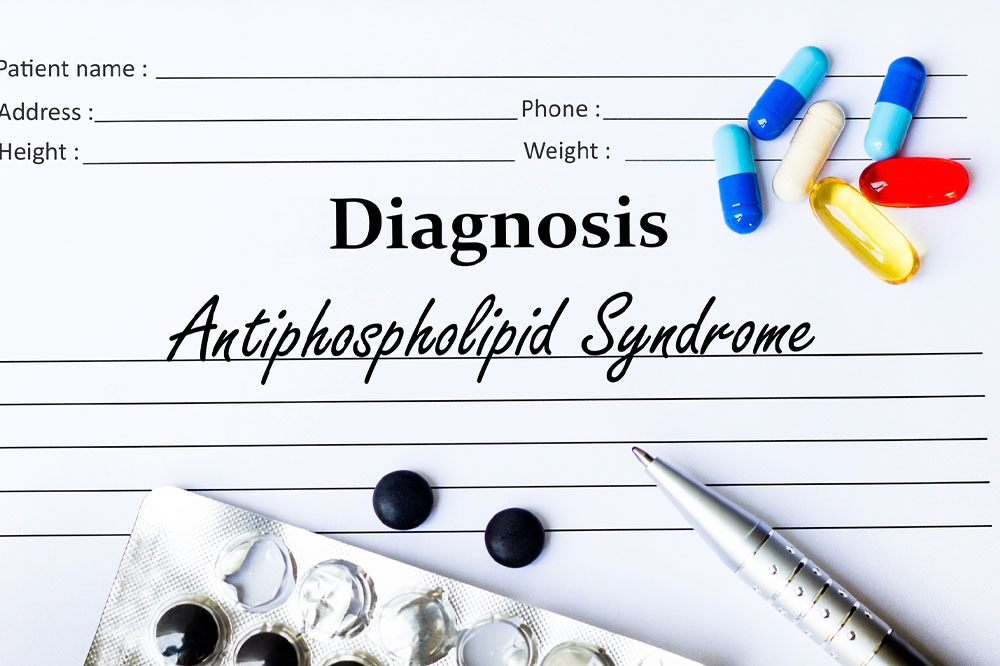 Antiphospholipid syndrome &#8211;  Symptoms, diagnosis, and more