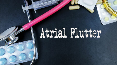 Atrial flutter &#8211; Symptoms, causes, diagnosis, and management