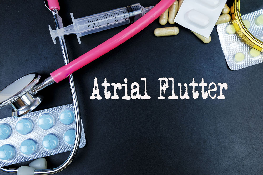 Atrial flutter &#8211; Symptoms, causes, diagnosis, and management