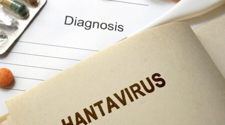 Hantavirus pulmonary syndrome &#8211; Signs, causes, and more